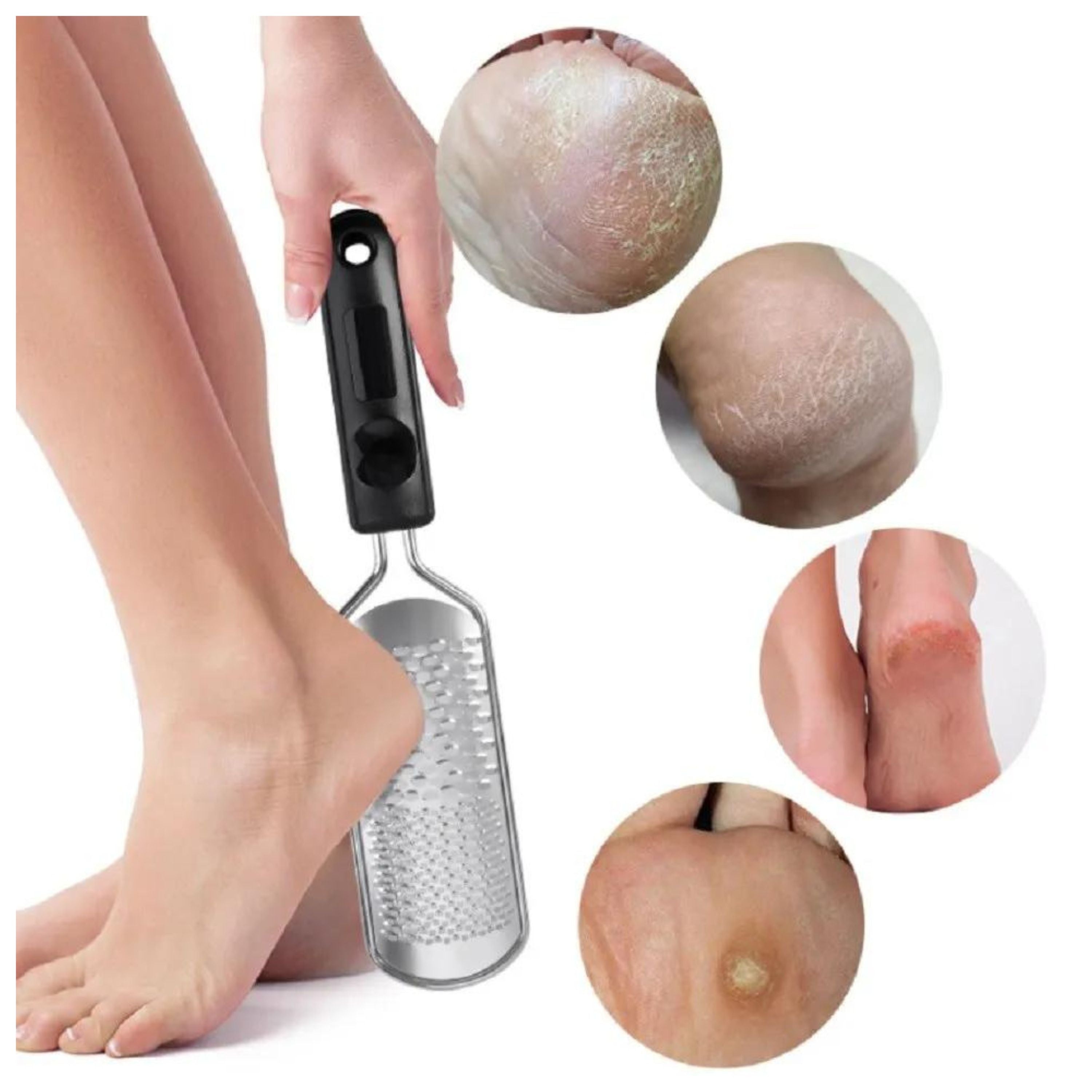 Kitcheniva Stainless Steel Pedicure Foot File