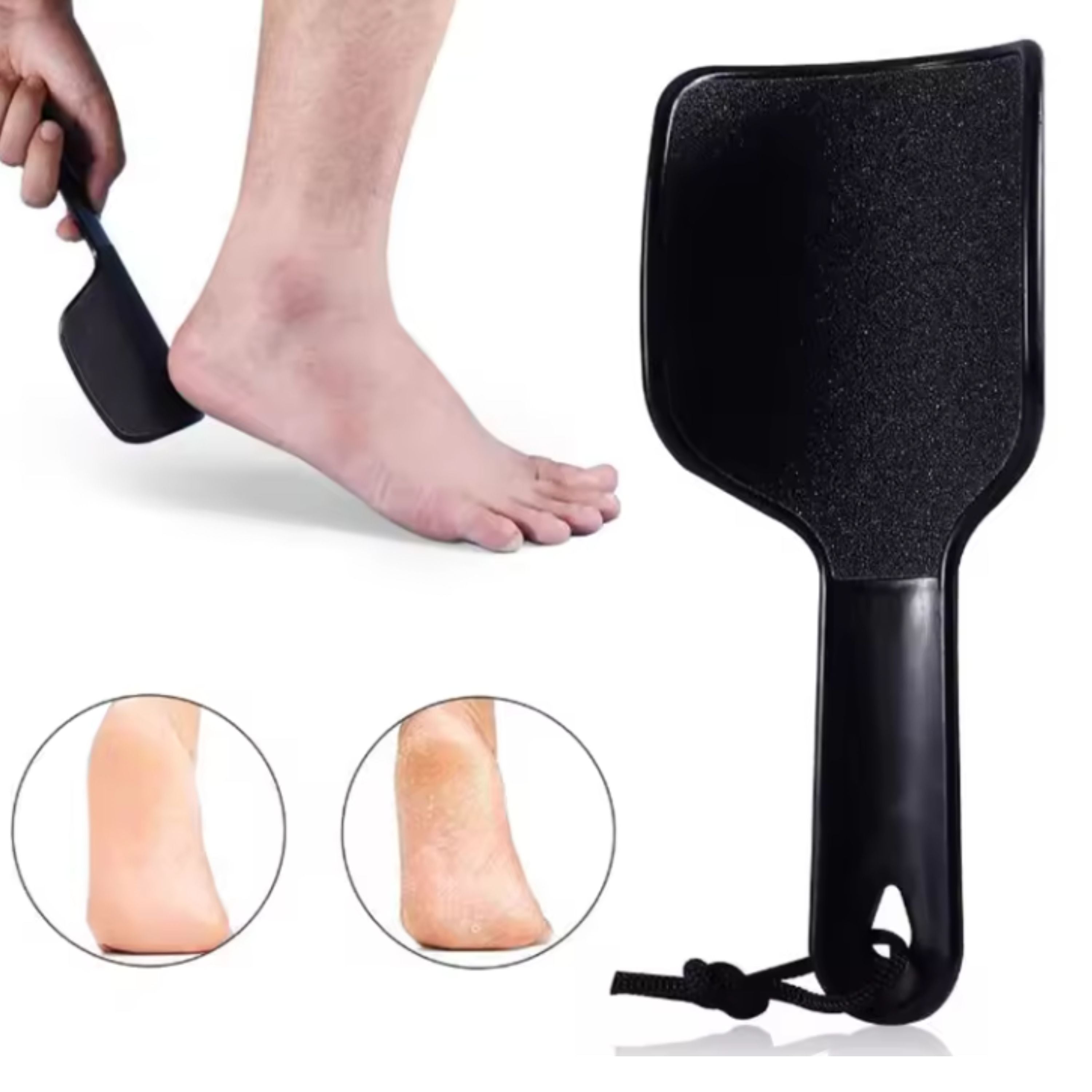 Kitcheniva Curved Foot File Callus Remover (1 Pack, Black)