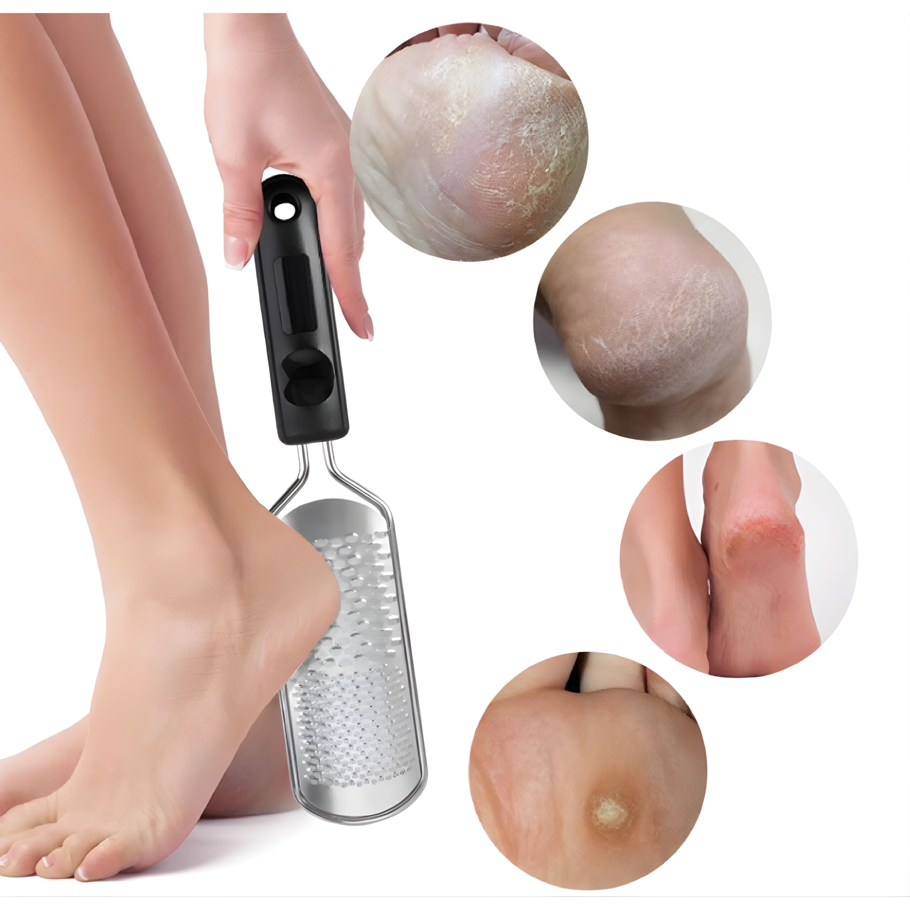 Kitcheniva Stainless Steel Pedicure Foot File