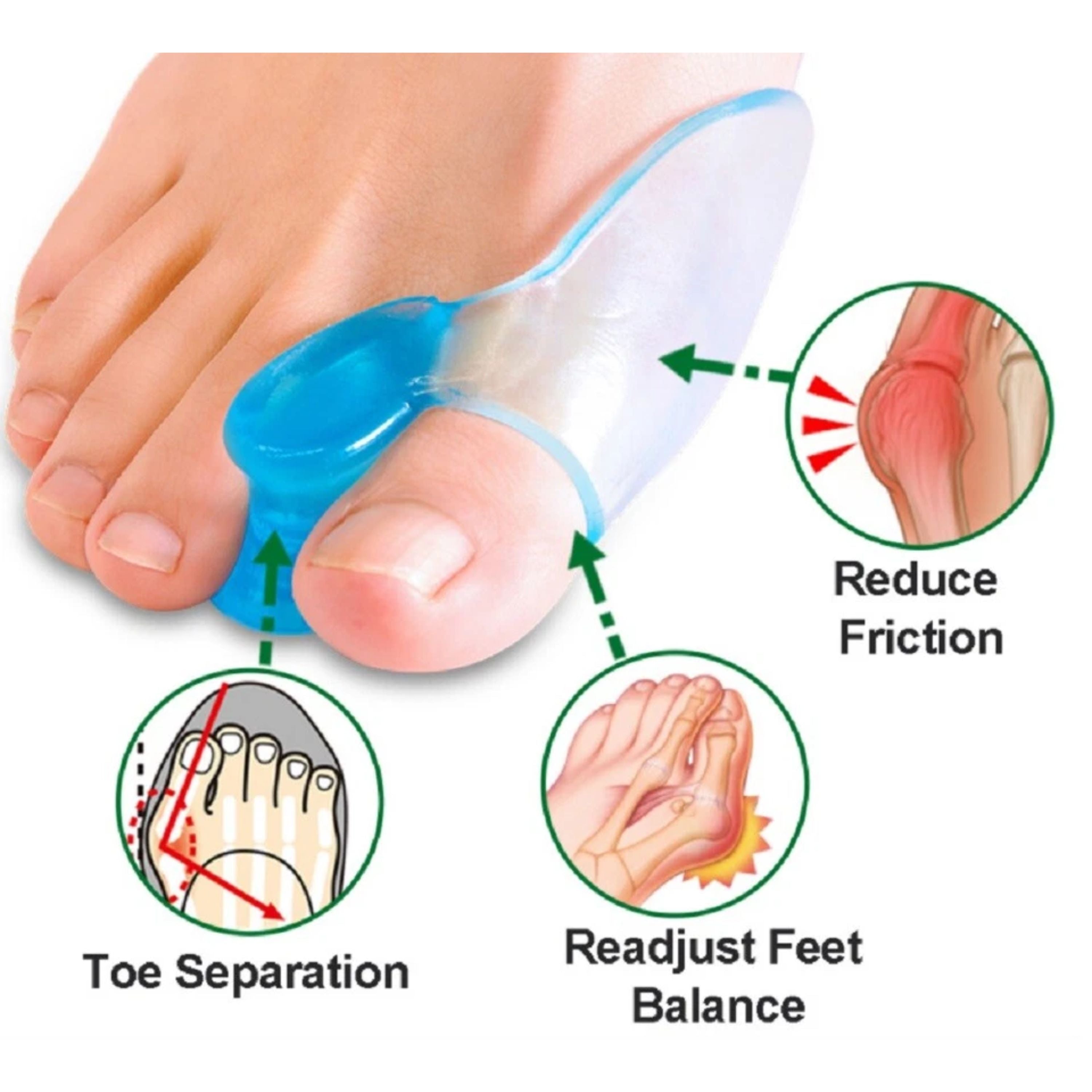 Kitcheniva Silicone Gel Bunion Corrector & Toe Separator 1 Pair
