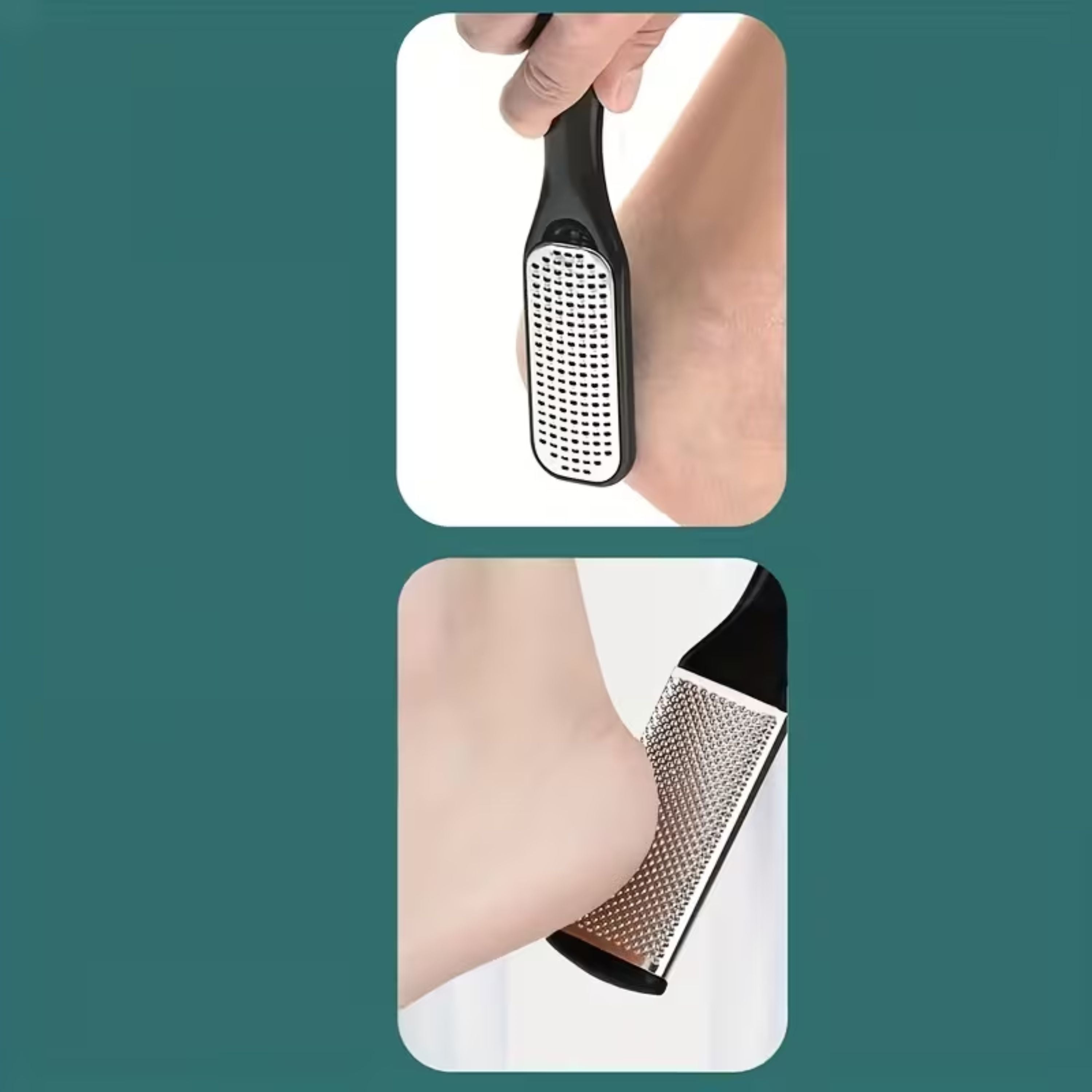 Kitcheniva 2 Pack Foot File Set - Callus Remover & Foot Scrubber