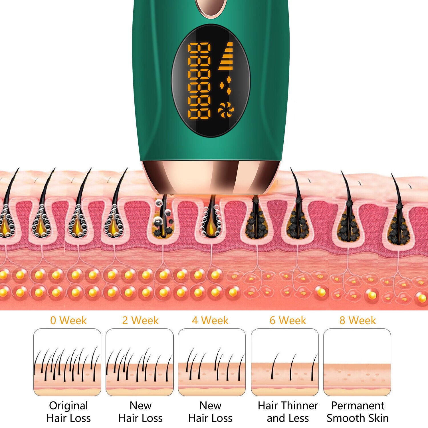 Kitcheniva Permanent IPL Laser Hair Removal Device