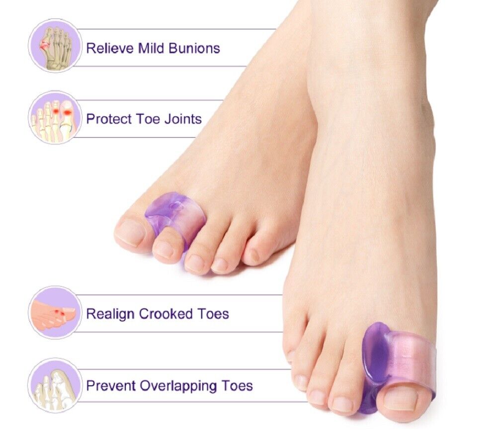 Kitcheniva 4 Pairs Silicone Gel Toe Separator