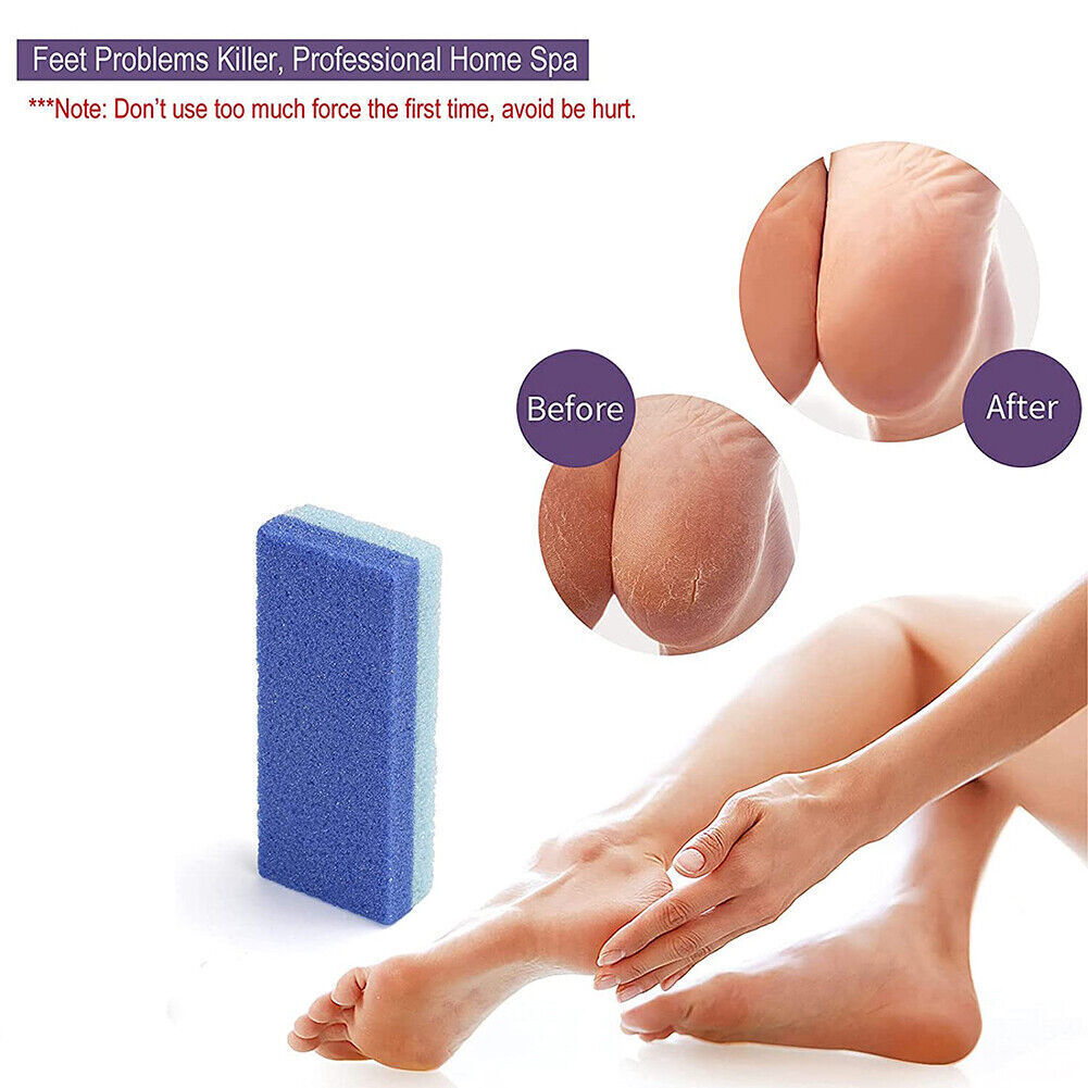 Kitcheniva 4-Pieces Maryton Foot Pumice Stone for Feet Hard Skin Callus Remover